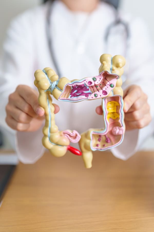 reparacion-intestinal-natural.jpg